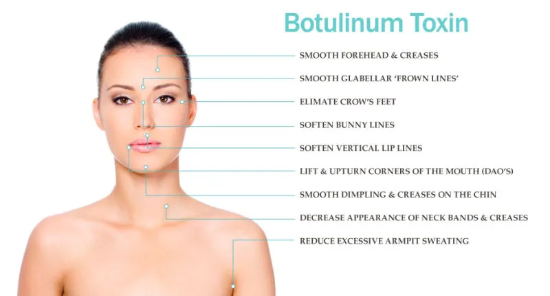 ضد چروک های لاغری Beutox Batulaxs Resty Filler Juvederms 0